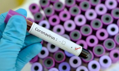 Mersin Tarsus Osb Başkanı Covite Yakalandı